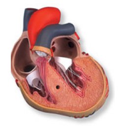 Hart met linker ventricular Hypertrophy 5LVH), 2 delig G04