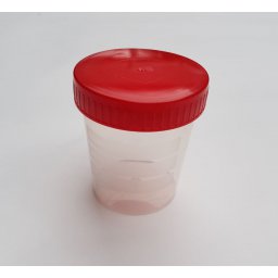 Bekers voor urinestaal