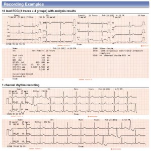 Electrocardiogram nihon kohden ECG-1150                  1st