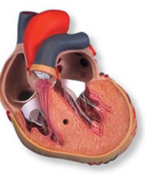 Hart met linker ventricular Hypertrophy 5LVH), 2 delig G04