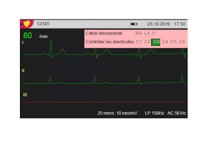 ECG Schiller cardiovit AT1 G2 met interpretatie 1st